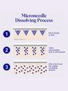 Self Dissolving Microneedle Patches