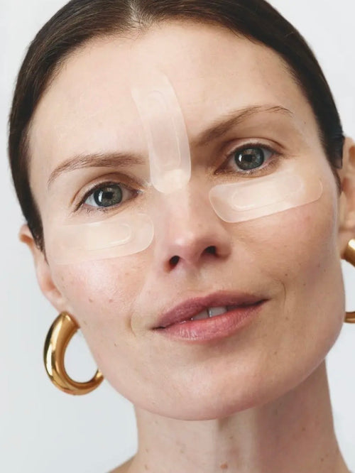 Self Dissolving Microneedle Patches